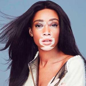 Winnie Harlow