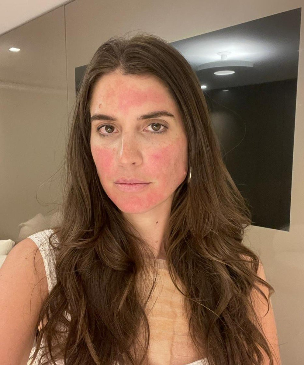 Manuela Bordasch - skincare-laser - laser fotona - outono - brasil - https://stealthelook.com.br