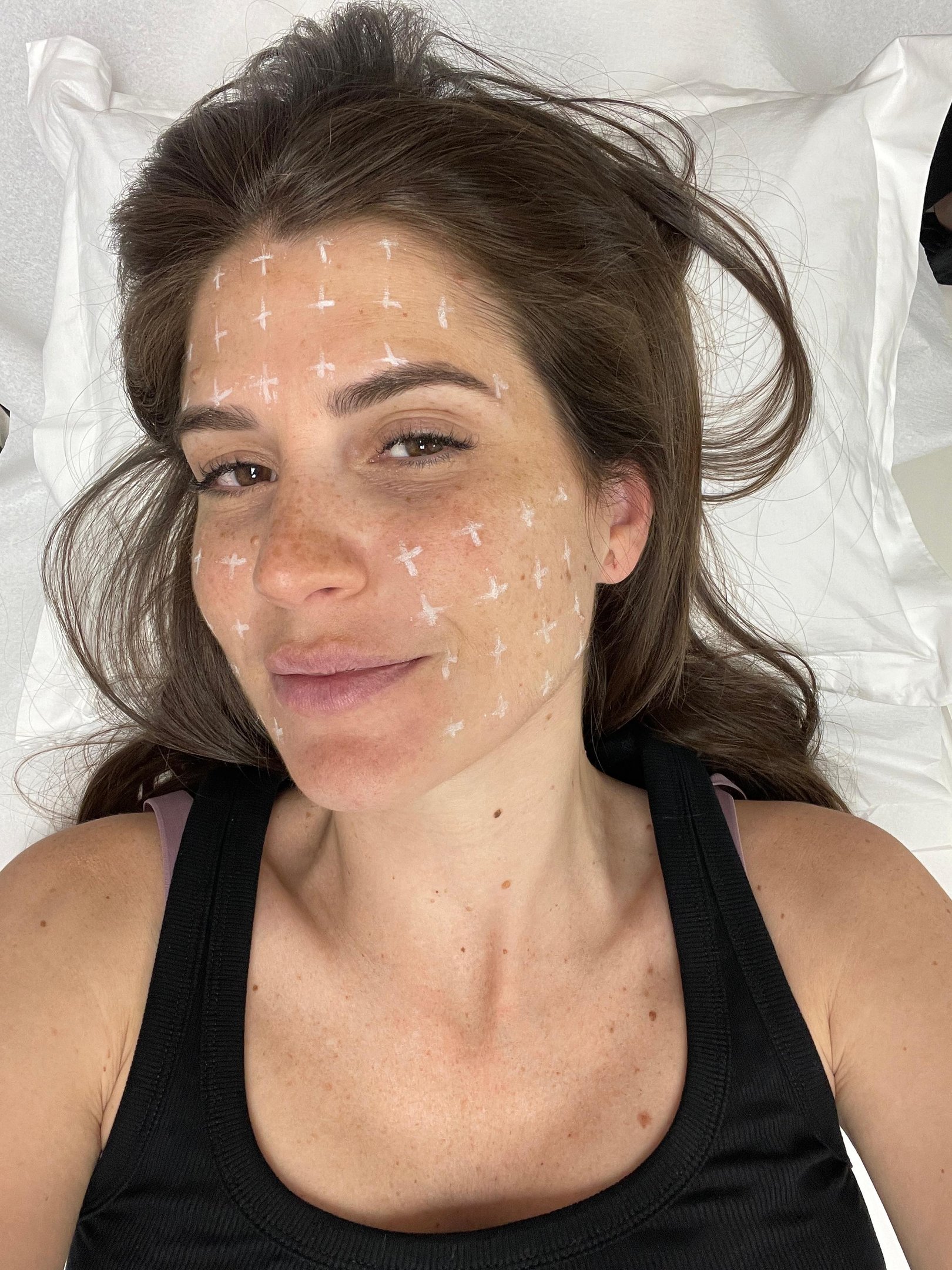 Mulher deitada com marcações no rosto. Teste de cuidado facial ou tratamento estético.