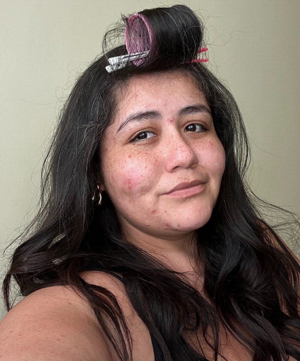 Mulher com pele com manchas, cabelo preso em bobes, olhar confiante.