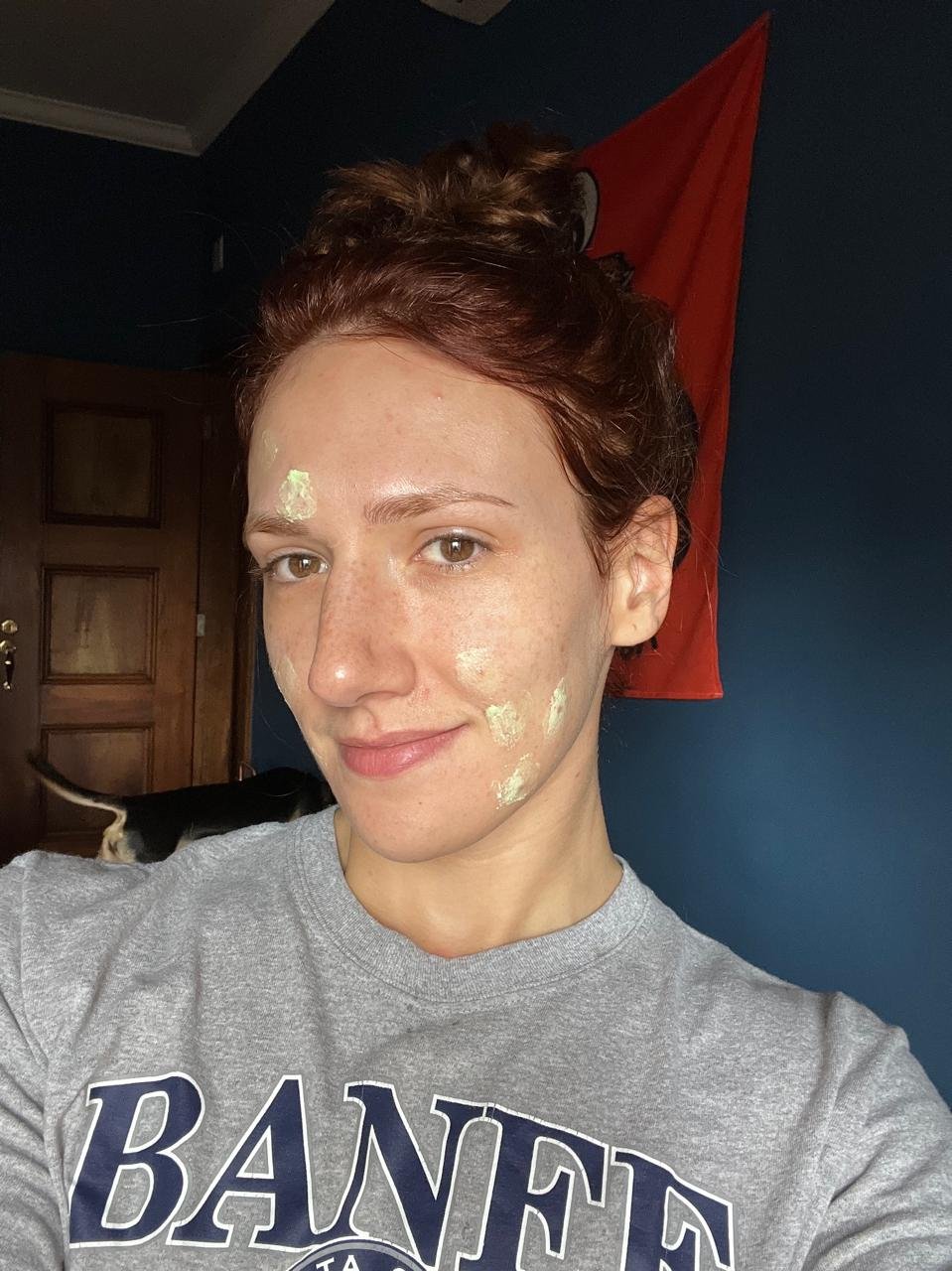 Minha experiência com a acne adulta e o tratamento com Roacutan