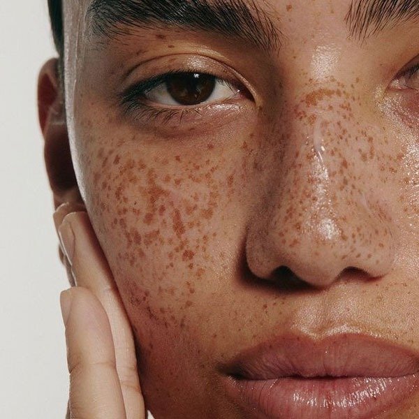 E o sérum da La Roche-Posay que promete reduzir em 85% as manchas na pele?
