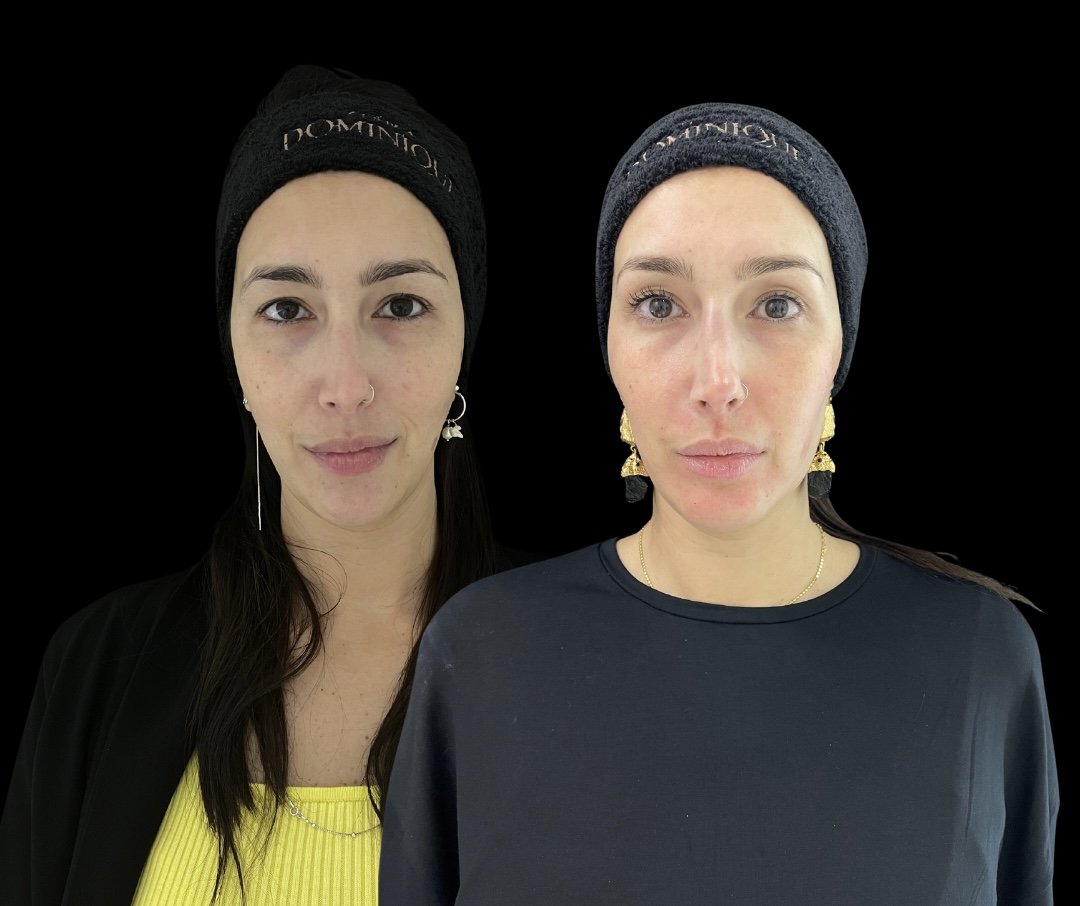 Duas mulheres lado a lado com expressões neutras, uma vestindo preto e a outra amarelo. Uso de acessórios harmoniza sutilmente.