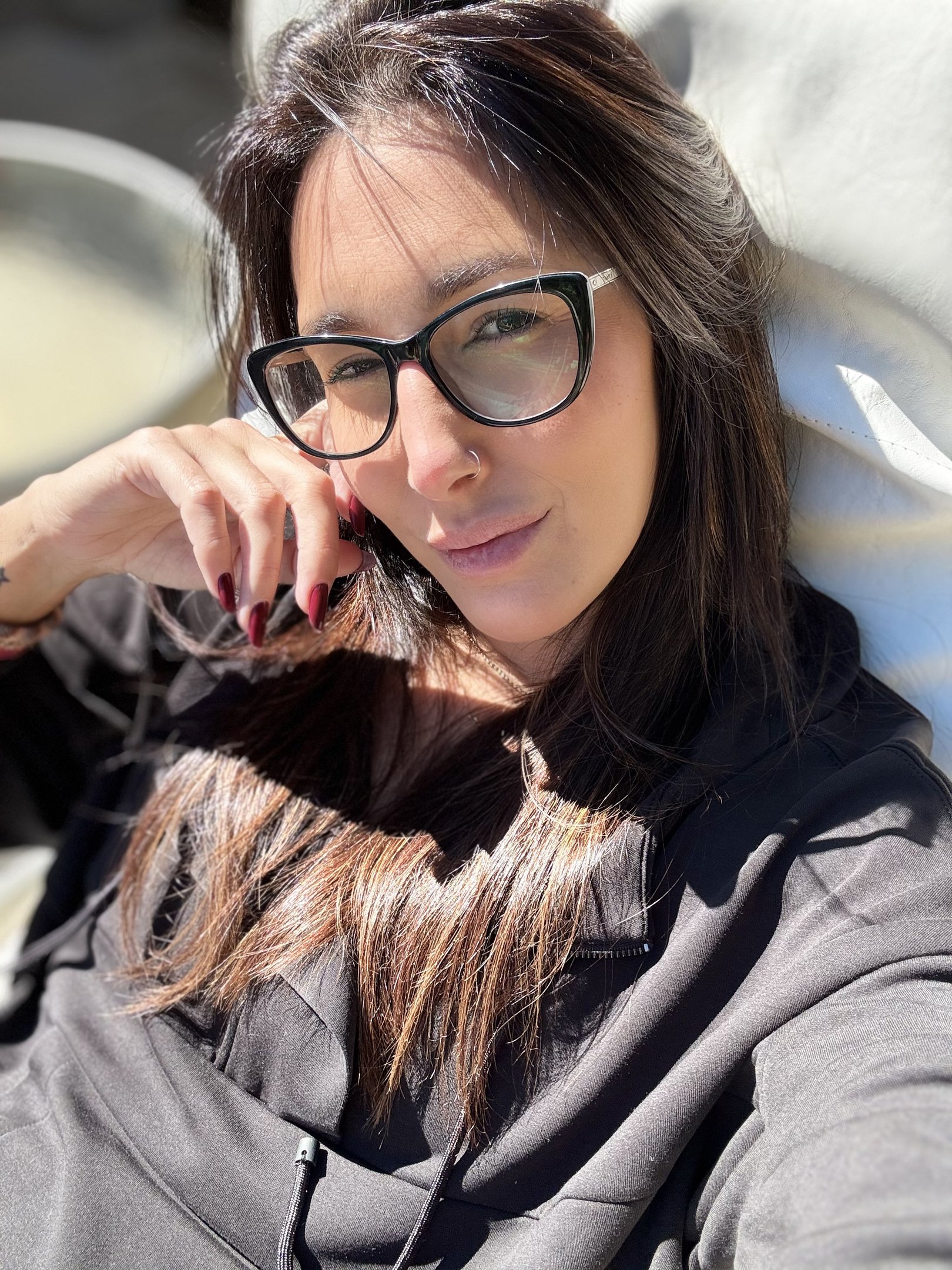 Bruna Fortino pós harmonização facial