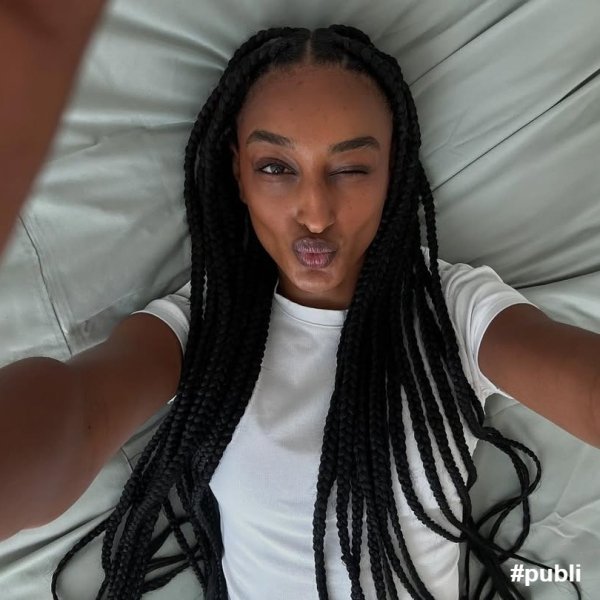 Mito ou verdade? Tudo que você precisa saber sobre as rugas por estresse