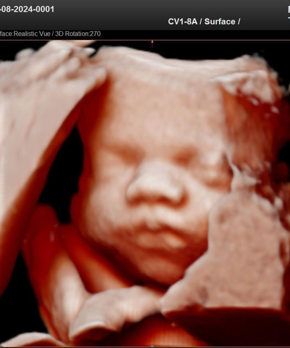 Ultrassom 3D mostra bebê em desenvolvimento no útero, simbolizando a fertilidade e a gestação saudável.