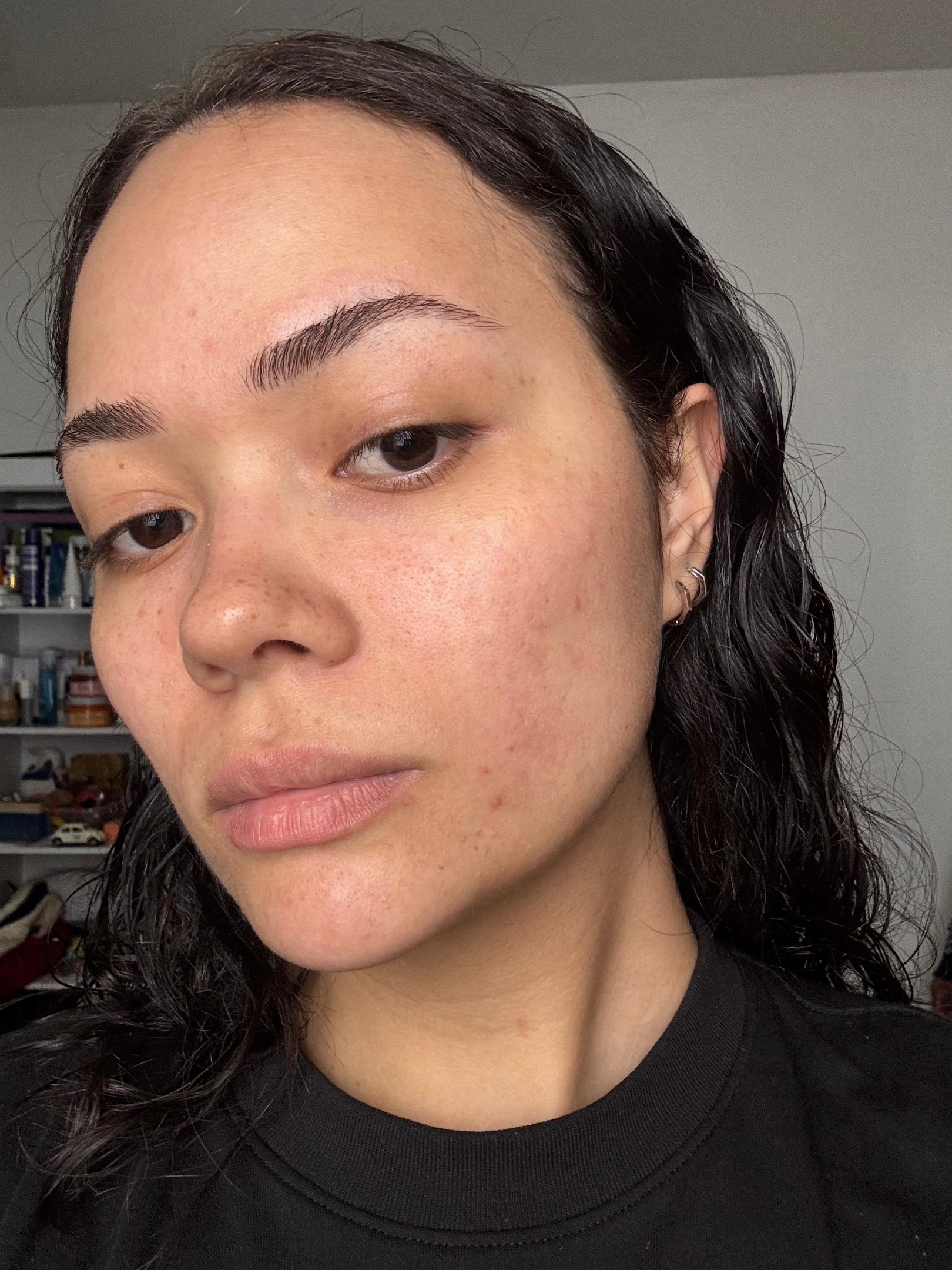 Mulher depois de produtos para pele oleosa com textura natural e sinais de acne leve, cabelo preto e molhado