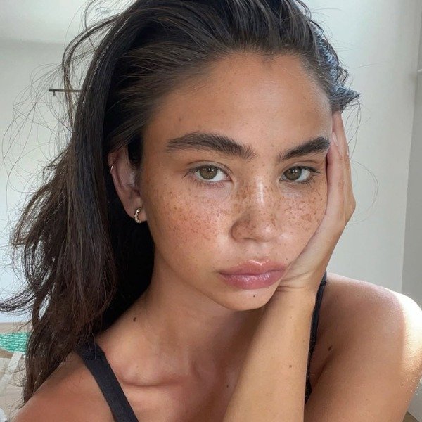 Transplante de sobrancelha: saiba tudo sobre o procedimento polêmico