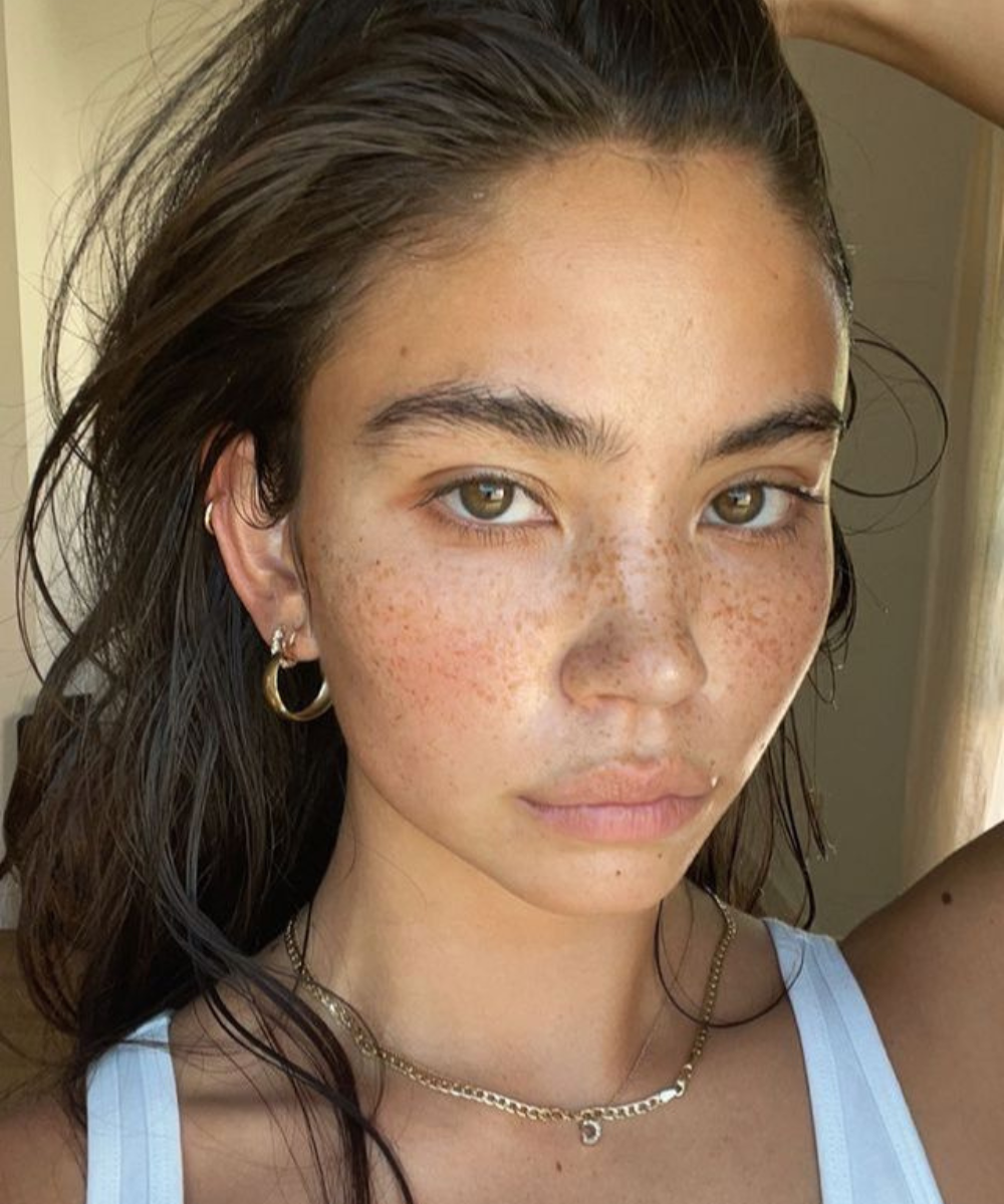 transplante de sobrancelha